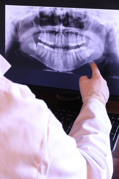 Best Emergency Wisdom Teeth Removal in Barstow, CA